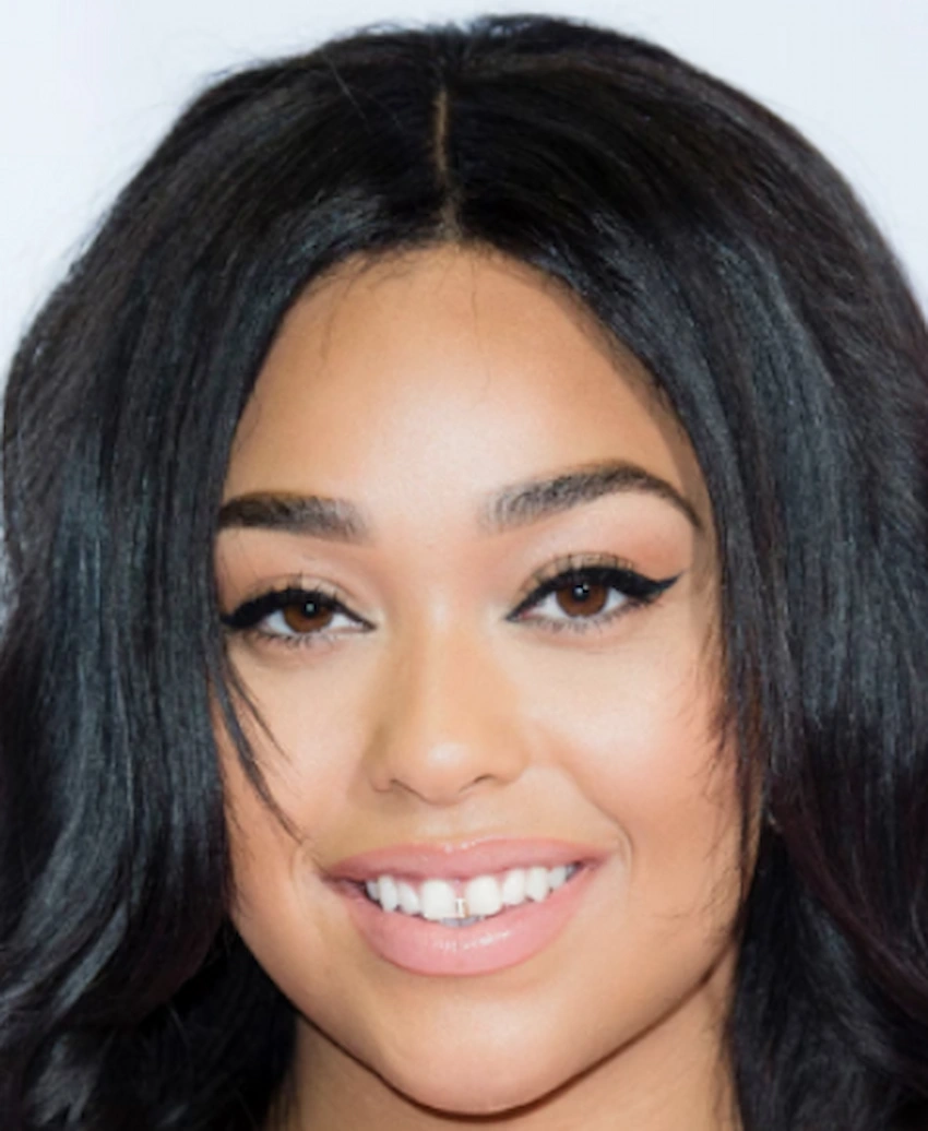 jordyn woods teeth 2010