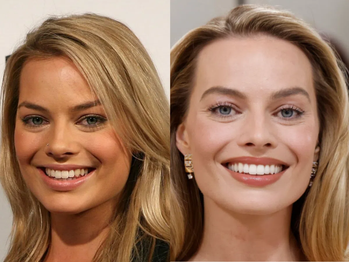 margot robbie teeth before after