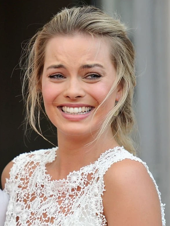  The Secret Behind Margot Robbie s Smile Porcelain Veneers LEMA