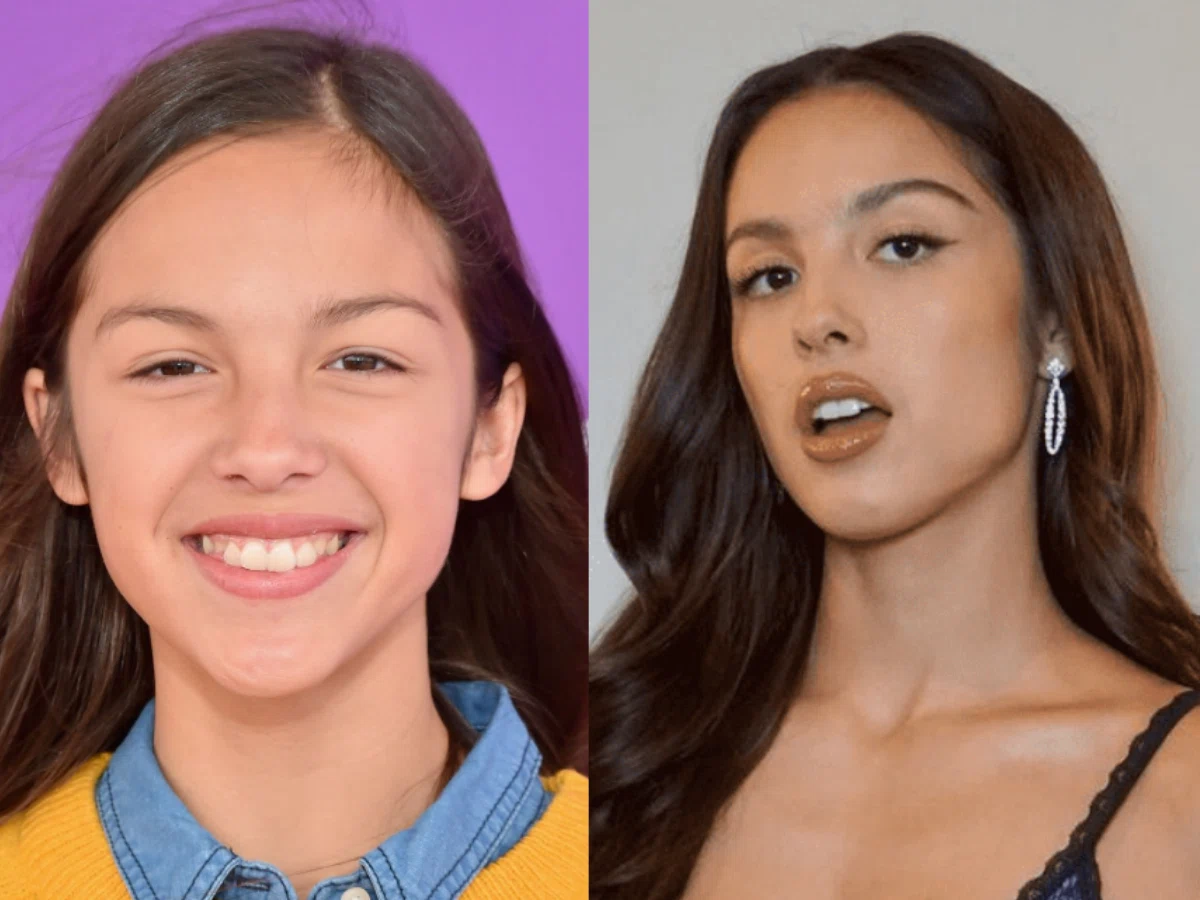 olivia rodrigo teeth before after