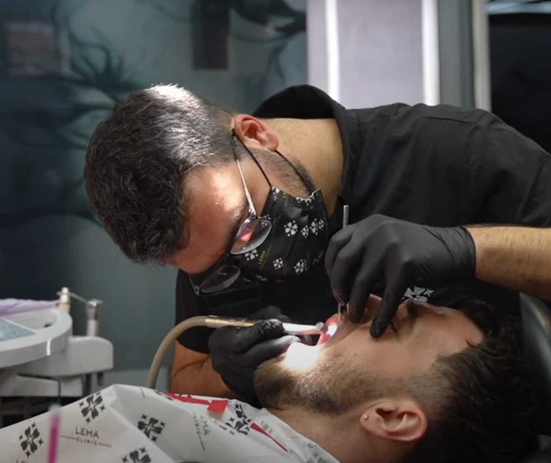 root canal treatment