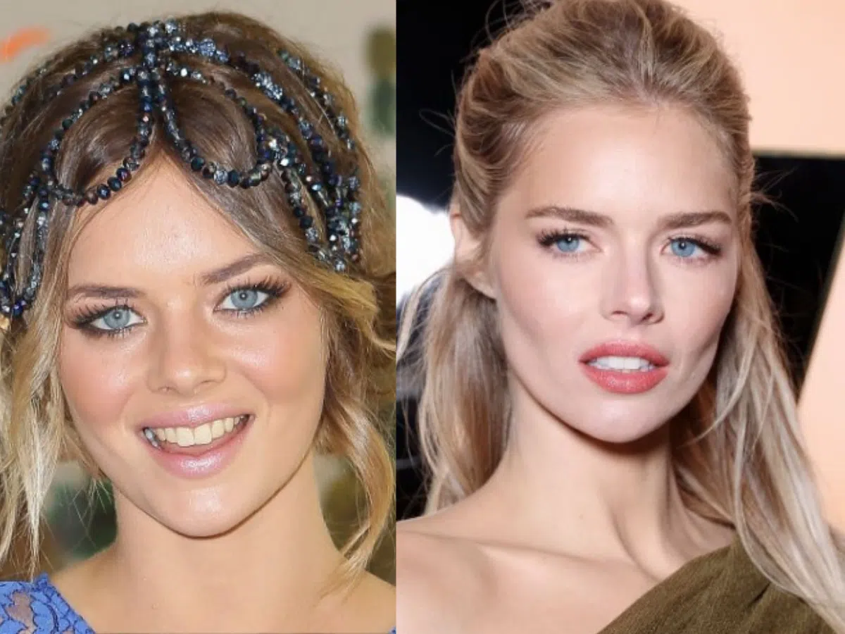 samara weaving teeth before after