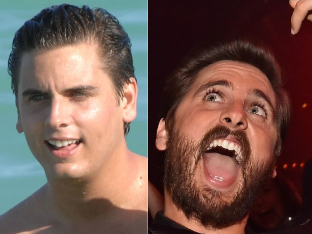 Scott Disick’s Hollywood Smile Is the New Definition of Luxury