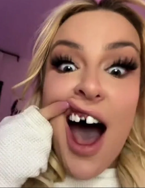 tana mongeau teeth in 2023