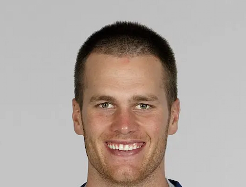 tom brady teeth 2005