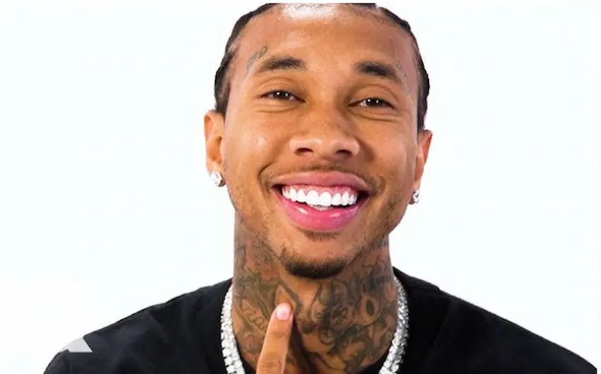 dinții lui Tyga în 2025