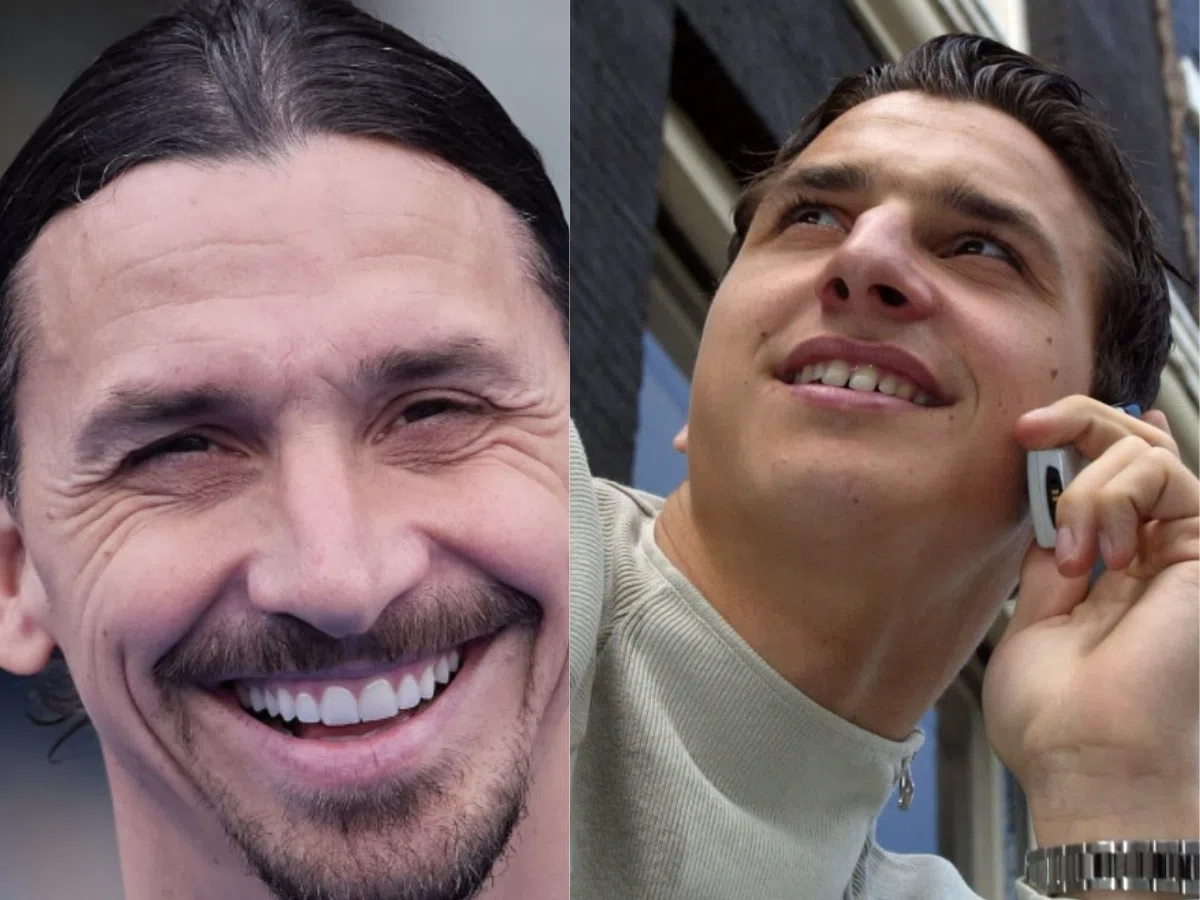 zlatan ibrahimovic teeth before after