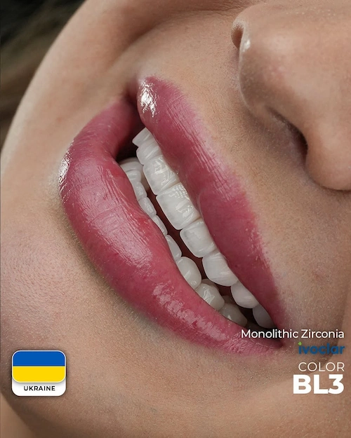A Smile That Suits Your Face 🤍When Gaana arrived from Ukraine, she said one thing “My teeth do (2)