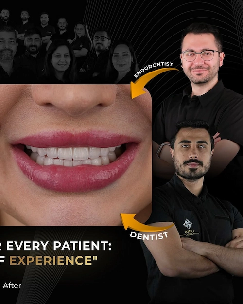 A Smile That Suits Your Face 🤍When Gaana arrived from Ukraine, she said one thing “My teeth do (5)