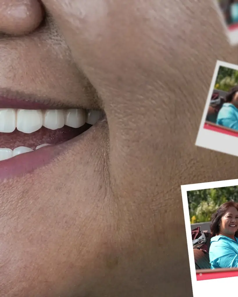 Лема Дентална Клиника предлага впечатляваща усмивка за 5 дни 🌟Лечение Hollywood Smile 😁Материал (2)