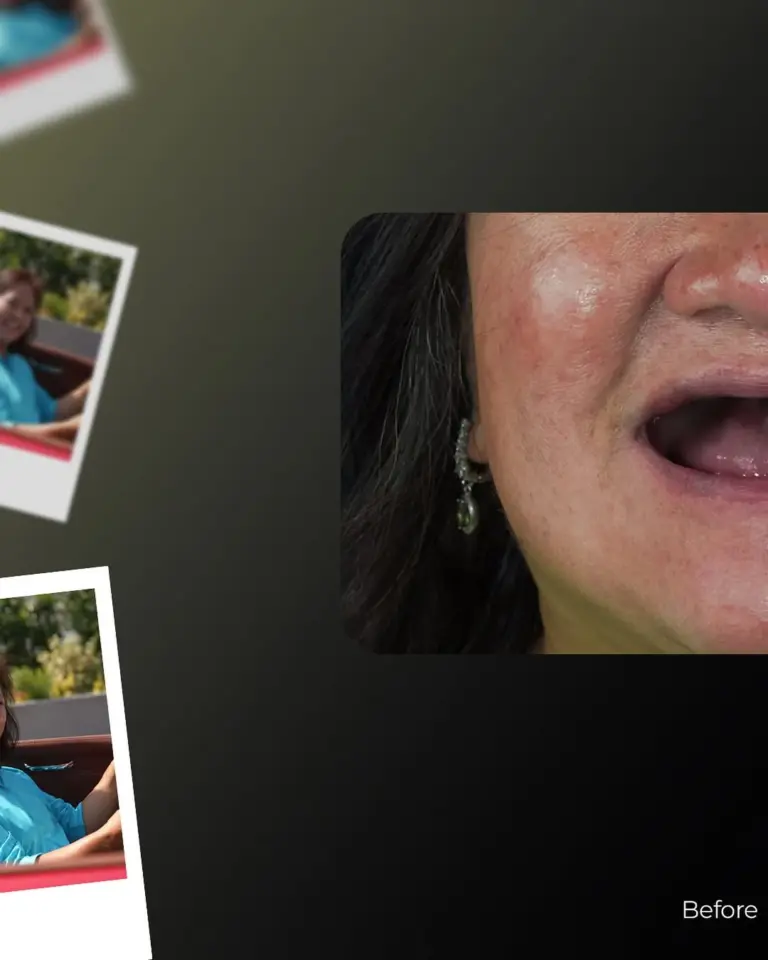 Lema Dental Clinic offers an impressive smile in 5 days 🌟Treatment Hollywood Smile 😁Material (3)