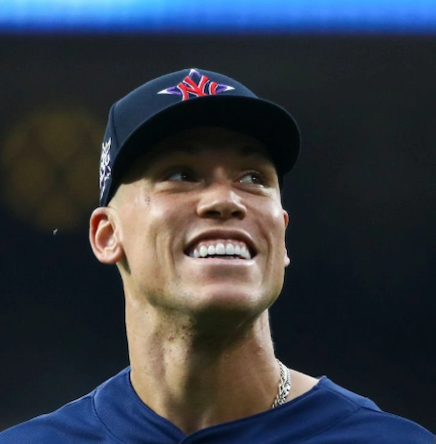 aaron judge teeth 2020