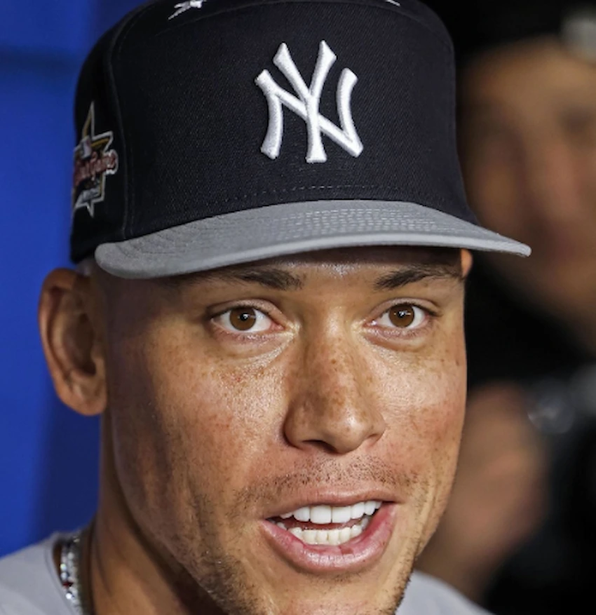 aaron judge teeth 2025