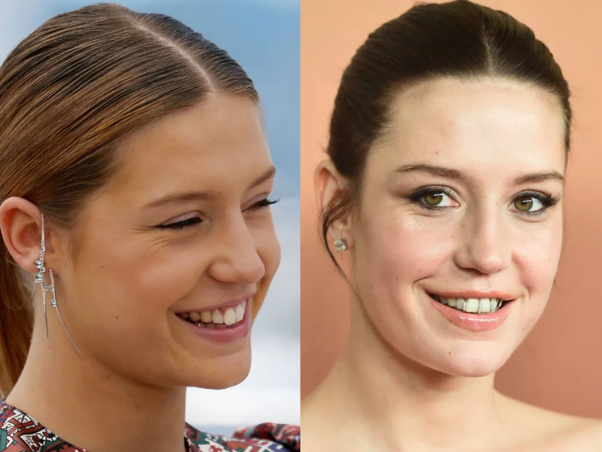 adèle exarchopoulos teeth before after