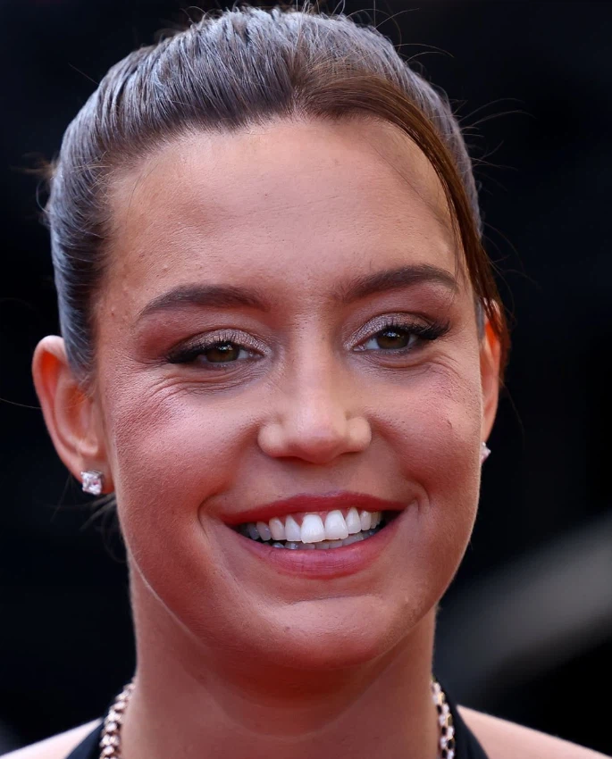 adèle exarchopoulos dientes en 2024