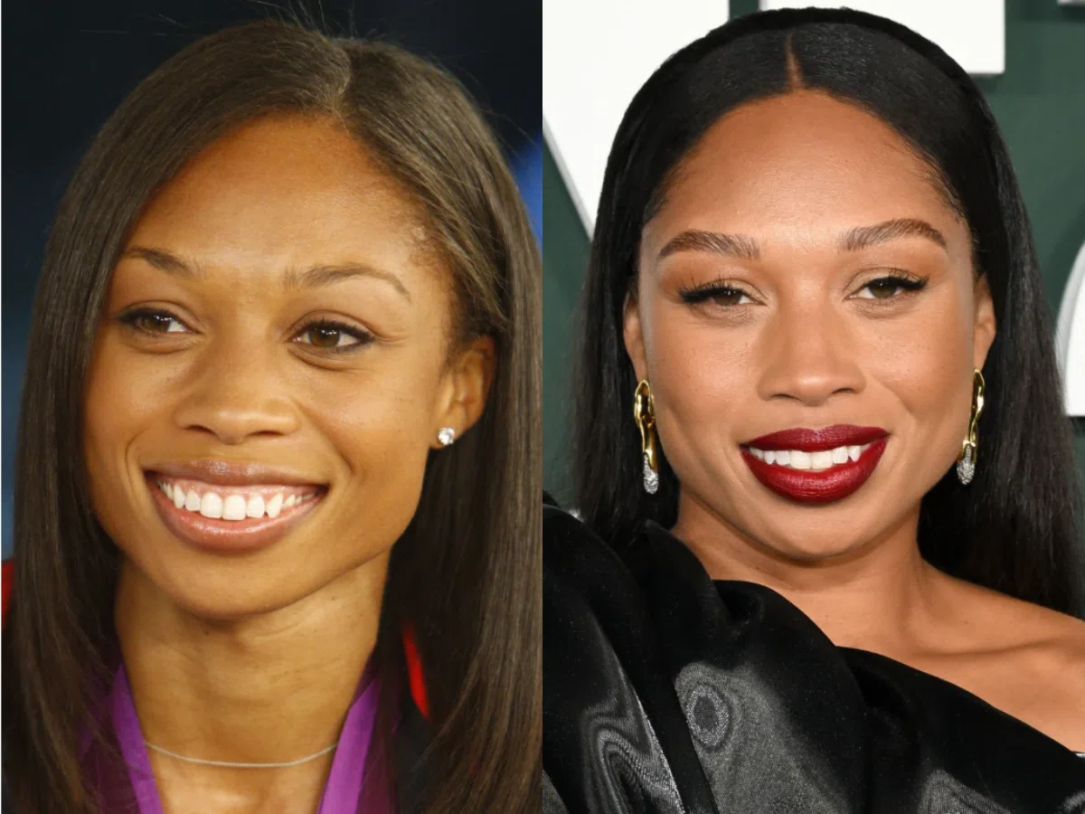 allyson felix teeth before after