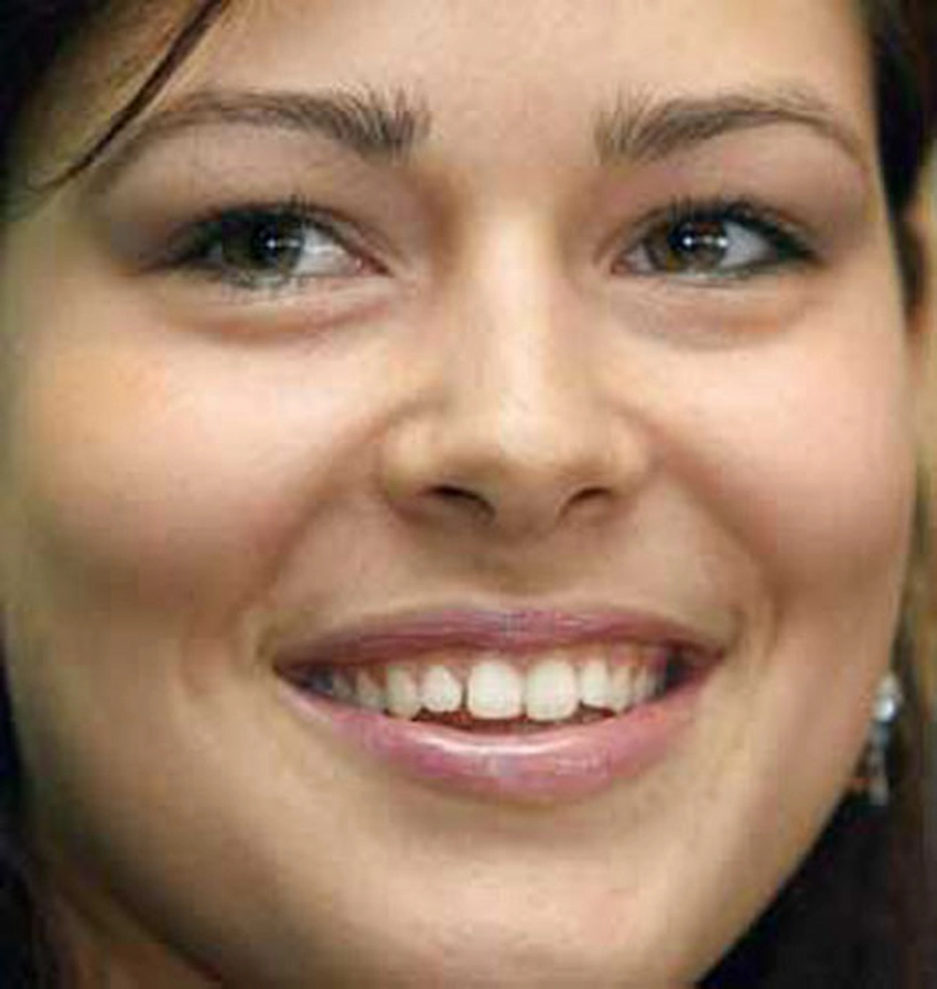 dinții ana ivanovic 2005