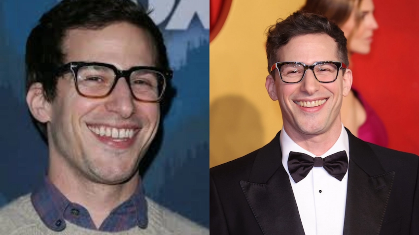 andy samberg teeth before after