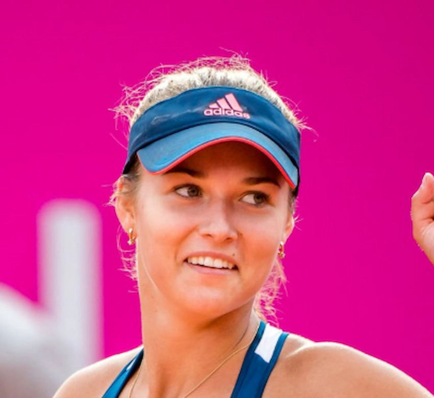 anna kalinskaya dientes 2017