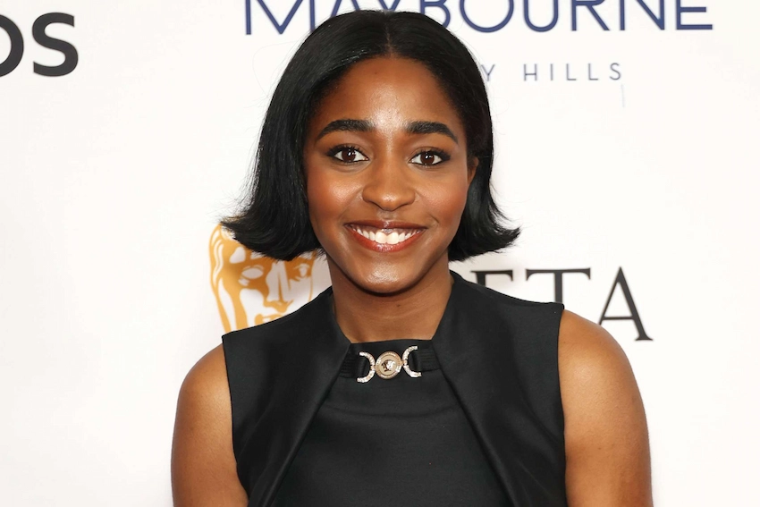 ayo edebiri tooth journey how she got her hollywood smile