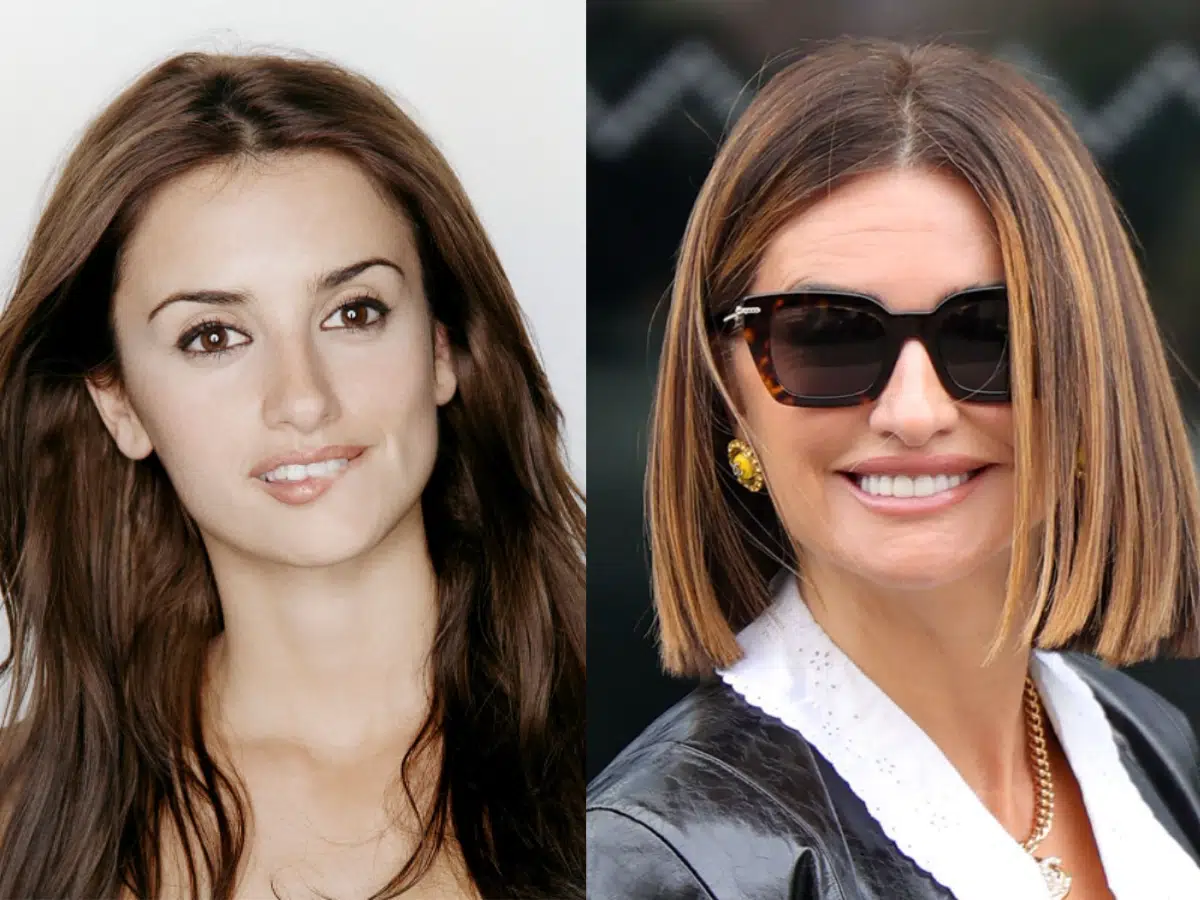 before (36)