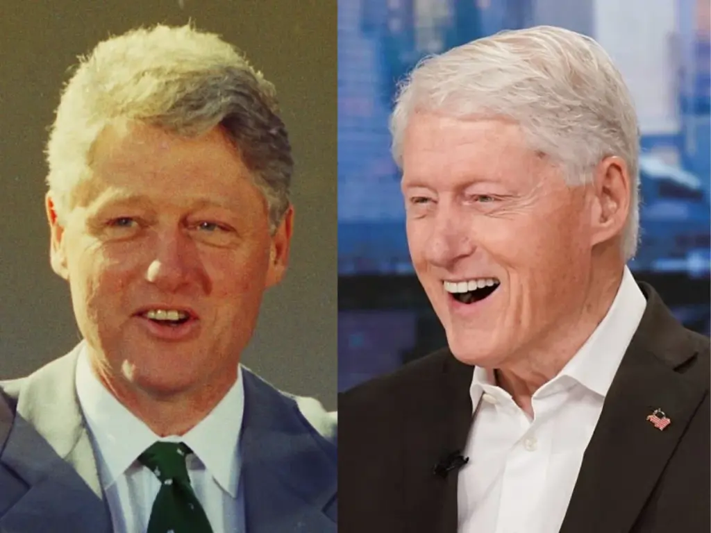 dientes de bill clinton antes y después