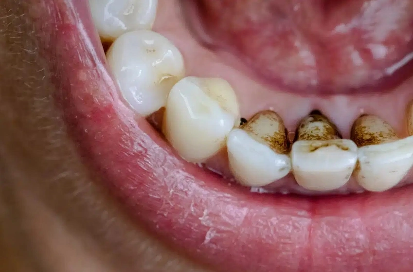 black stains