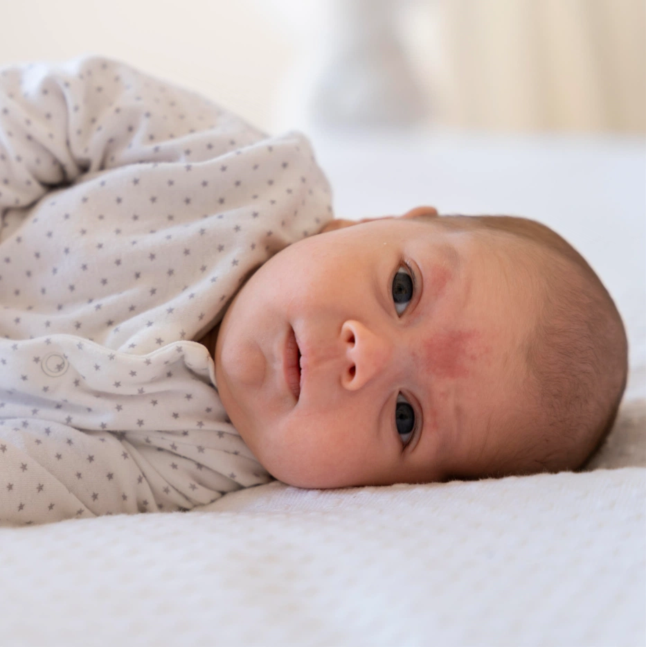 body rash during teething