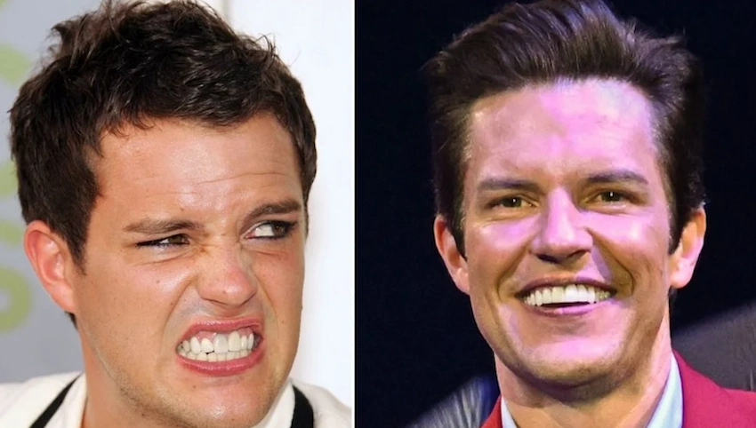 brandon flowers teeth before after