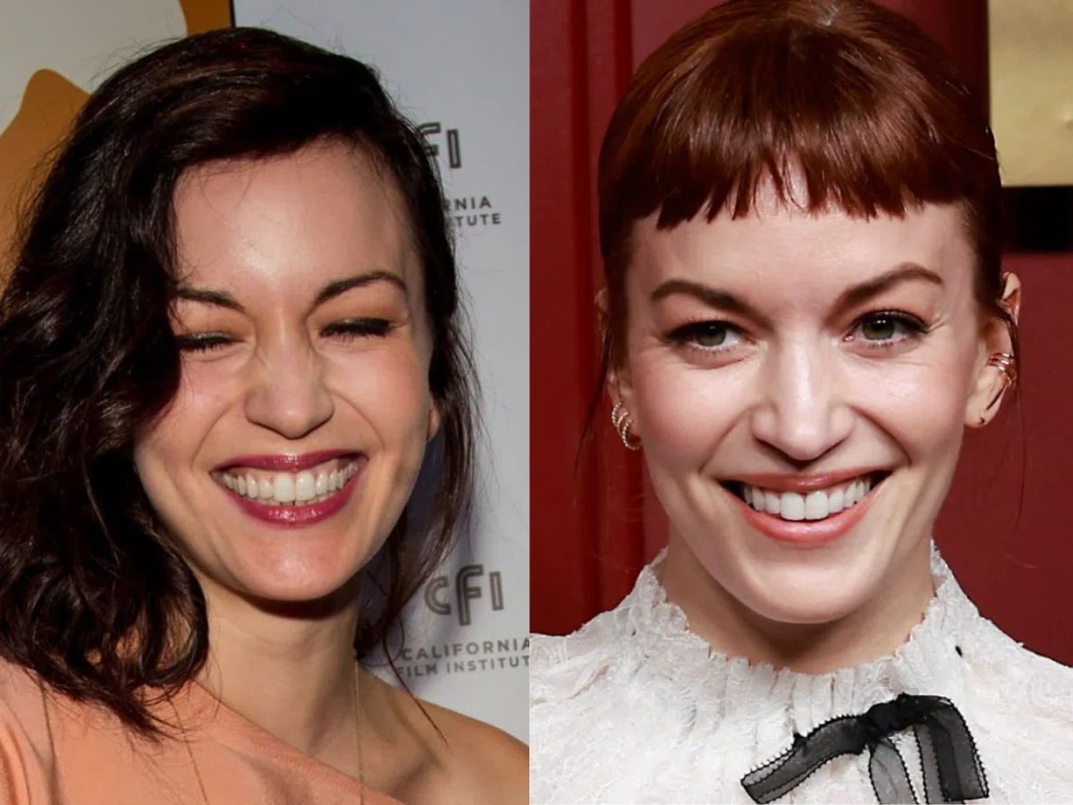 britt lower teeth before after