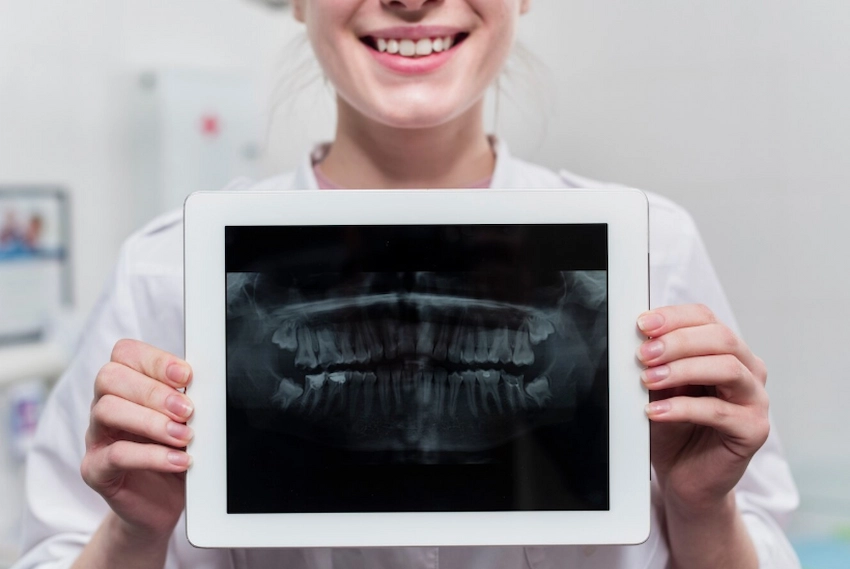le radiografie dentali panoramiche possono essere considerate dannose