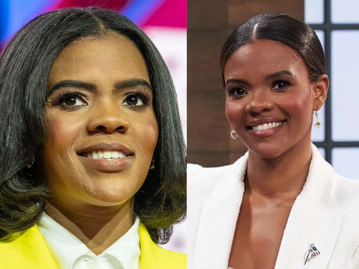 candace owens teeth before after