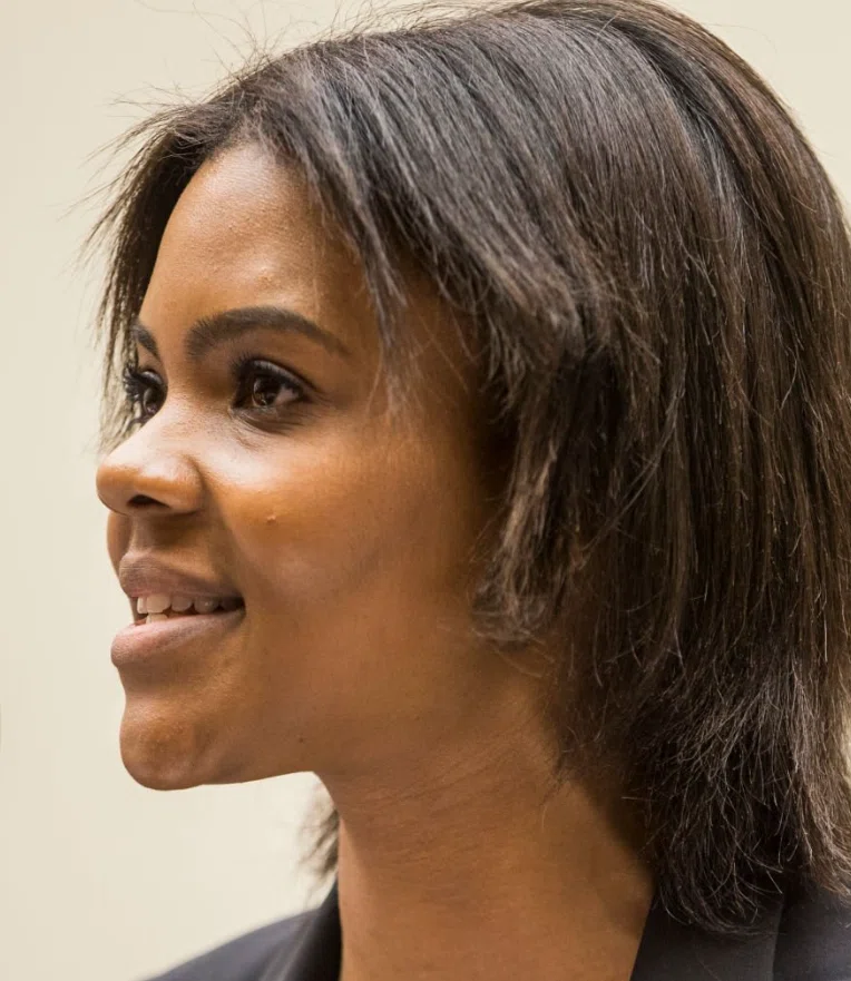 candace owens teeth in 2018