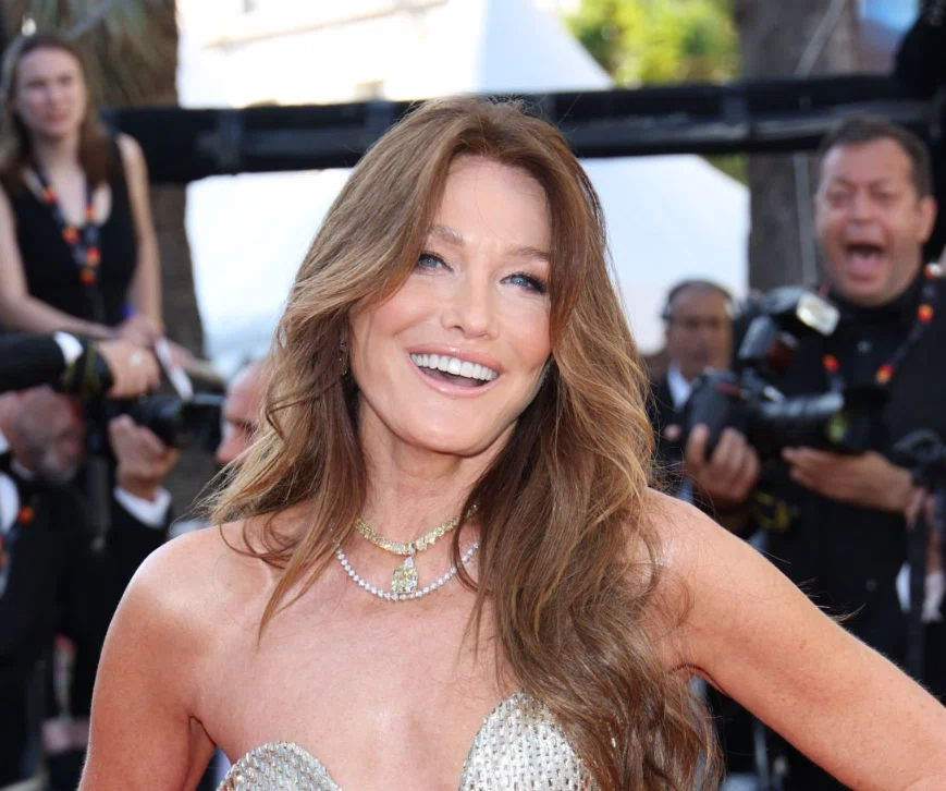 dientes de carla bruni sarkozy