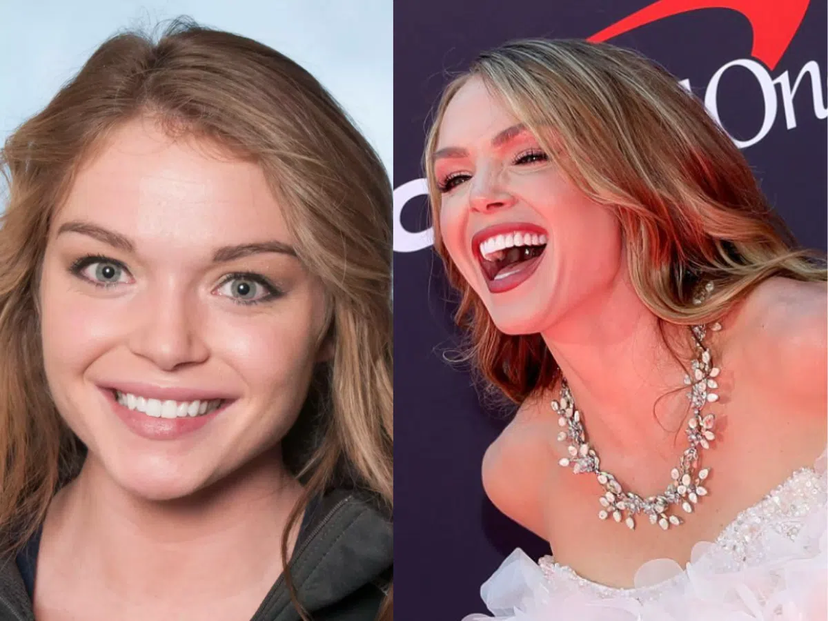 chari hawkins teeth before after