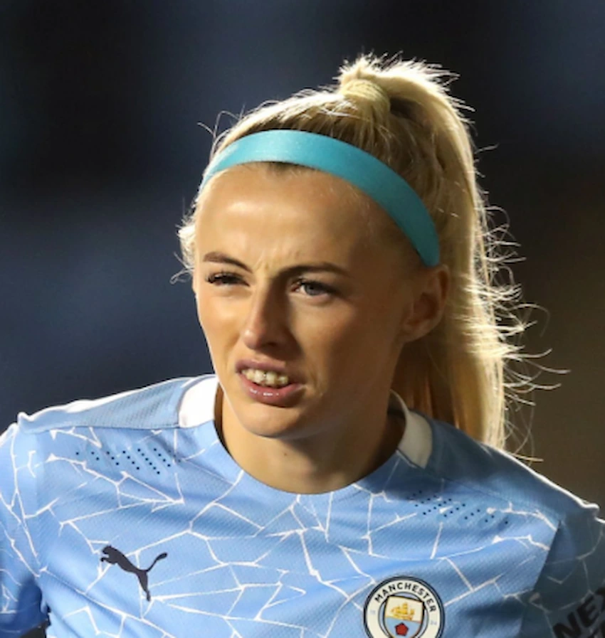 chloe kelly teeth 2020