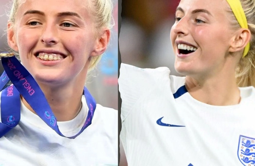 chloe kelly teeth before after