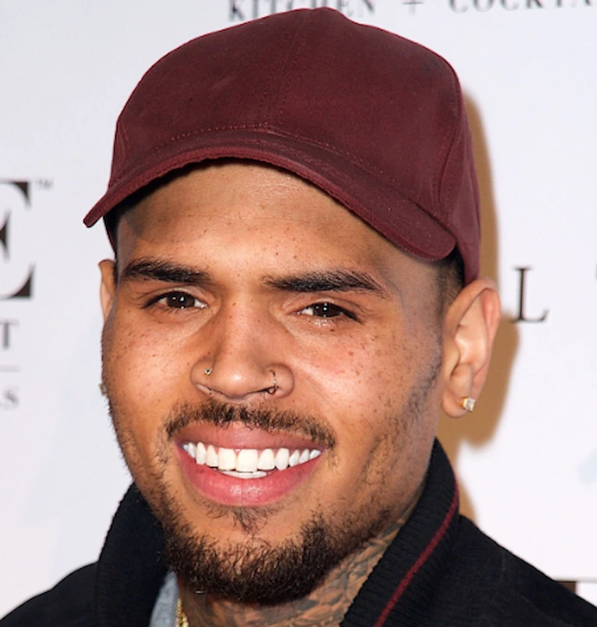 chris brown teeth 2015