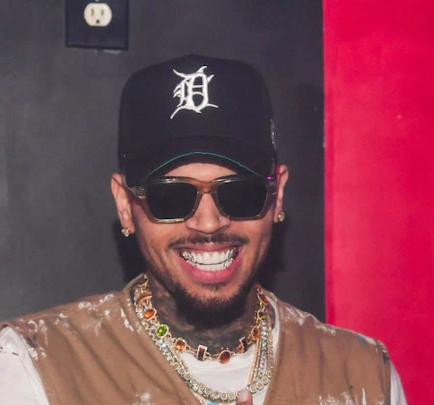 chris brown teeth 2025