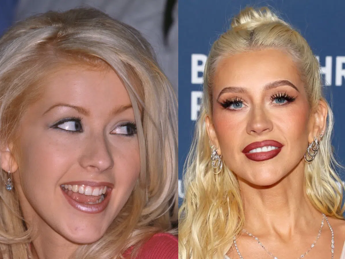 christina aguilera teeth before after