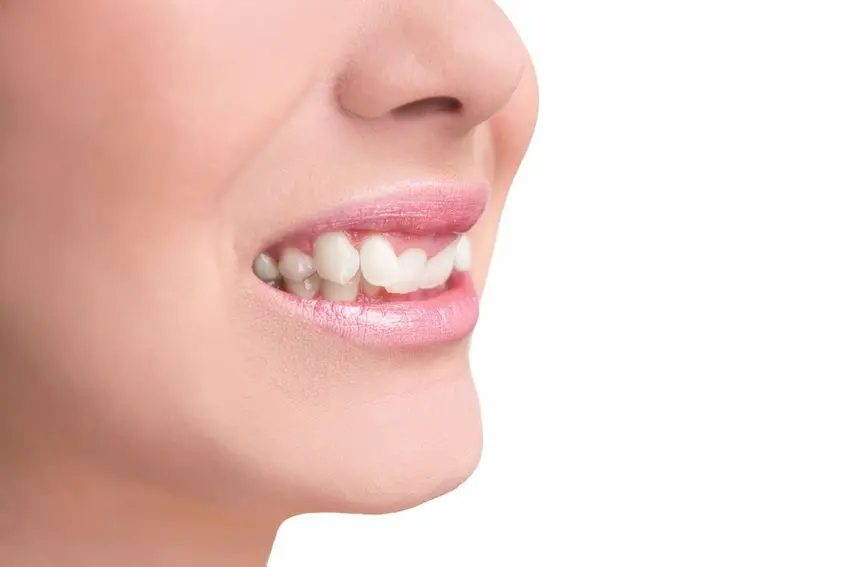 crocked teeth causes