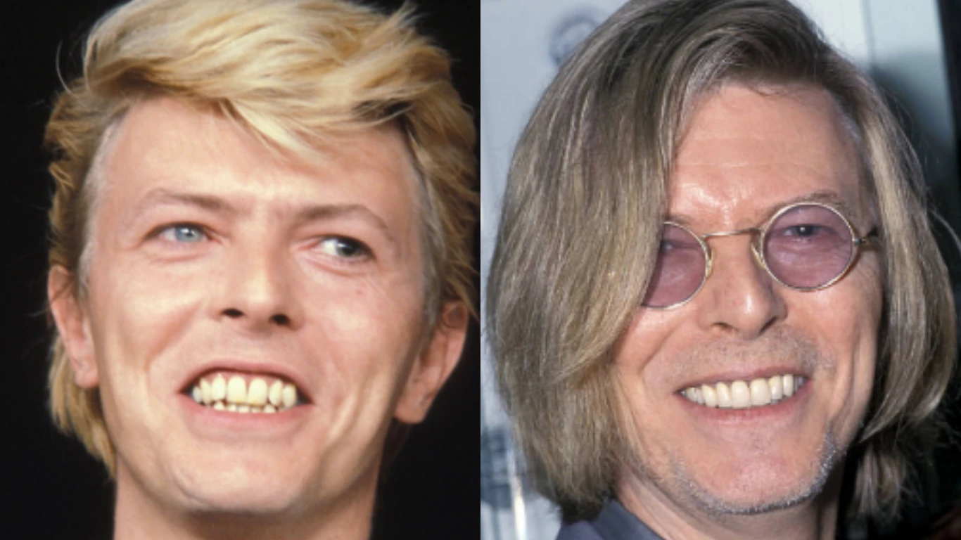 david bowie before and after photo