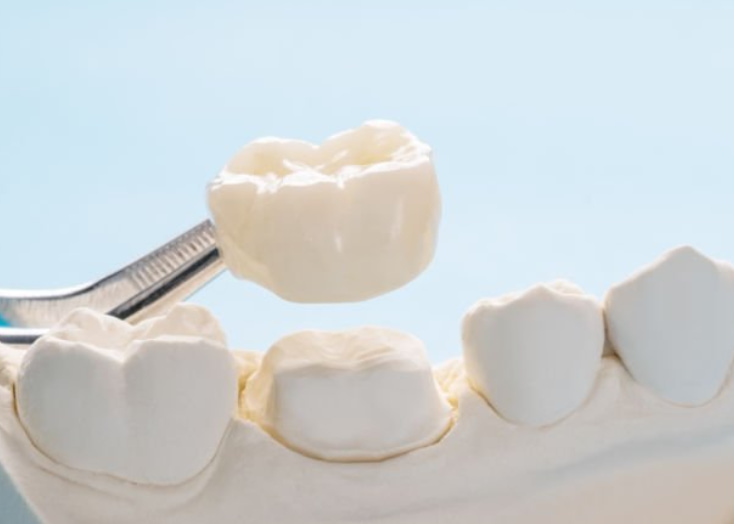 dental crowns