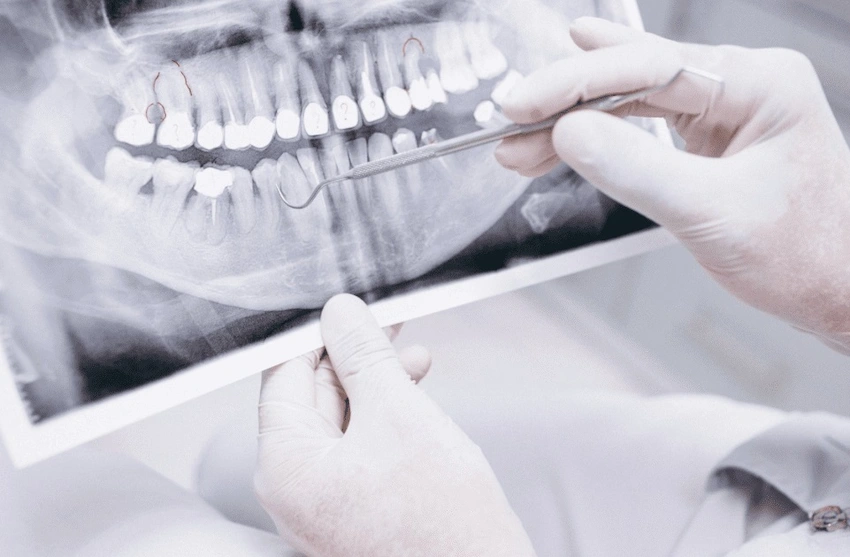 dental x ray