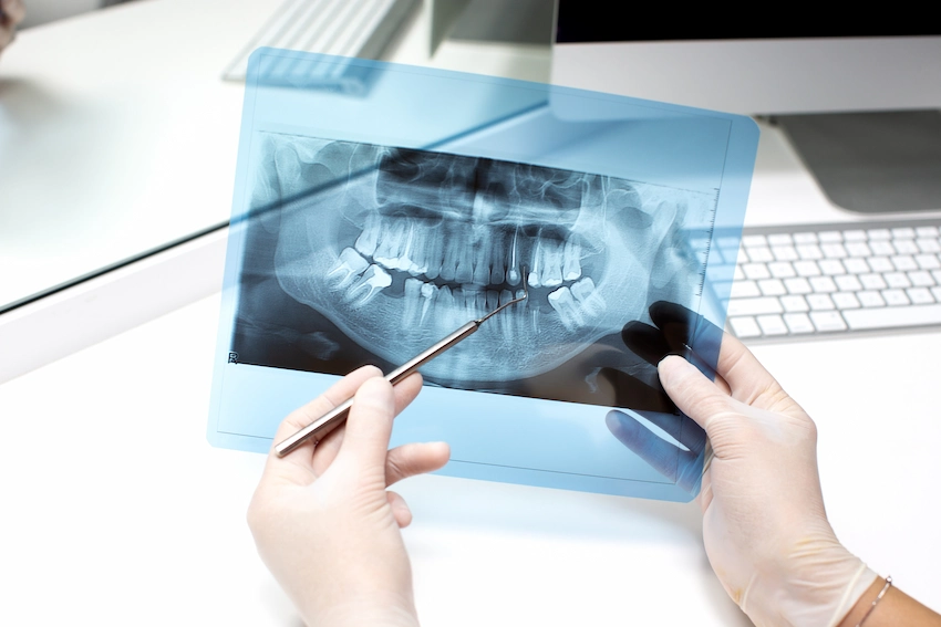 radiografía dental