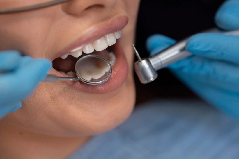 dentiste utilisant des instruments