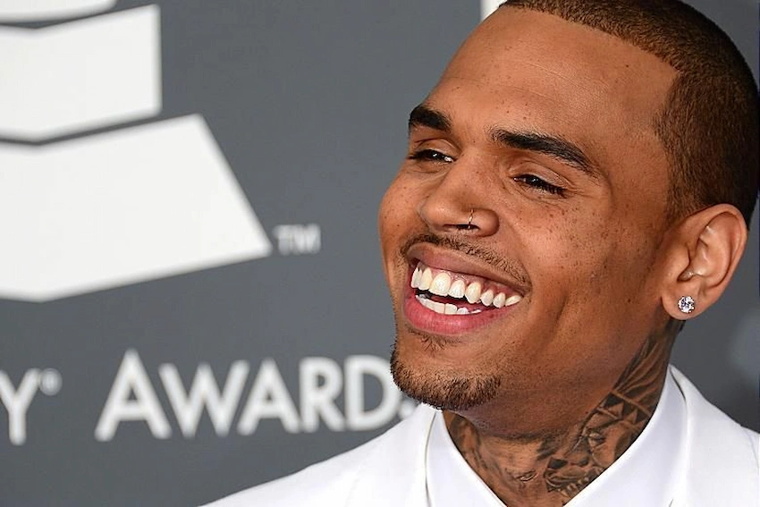 did chris brown get his teeth fixed