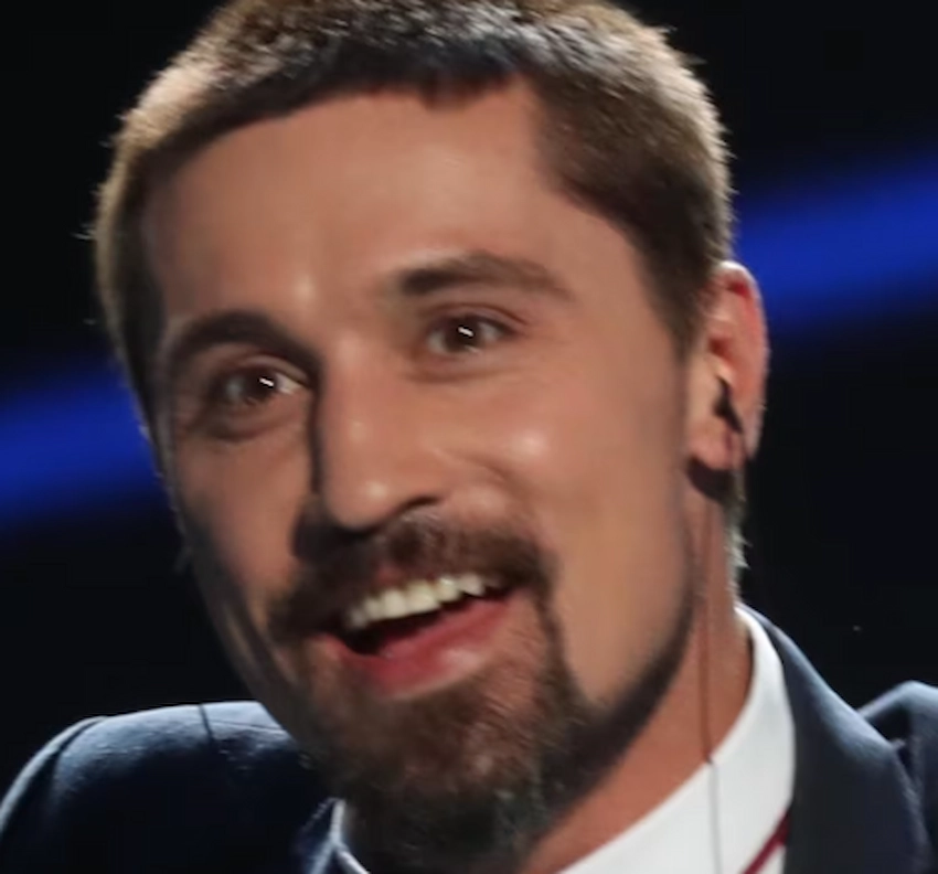 dima bilan teeth 2025