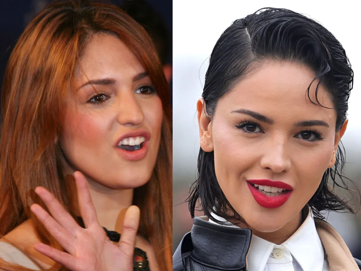 eiza gonzález teeth before after