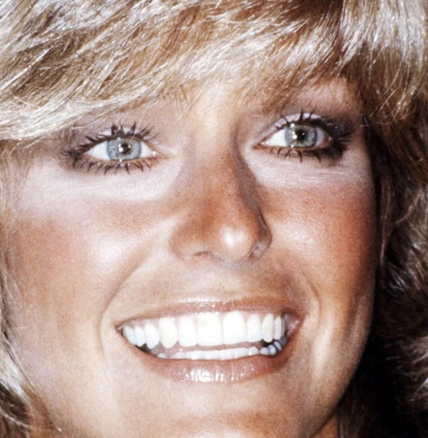 farrah fawcett teeth